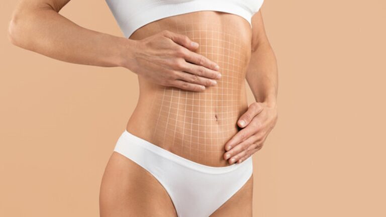 Bölgesel İncelme İçin Bütçe Dostu Liposuction Seçenekleri