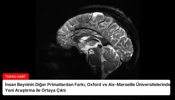 İnsan Beyninin Diğer Primatlardan Farkı, Oxford ve Aix-Marseille Üniversitelerinden Yeni Araştırma ile Ortaya Çıktı